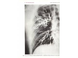 Studieboeken Gray's Anatomy - Henri Gray -  Engels - English