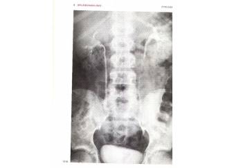 Studieboeken Gray's Anatomy - Henri Gray -  Engels - English