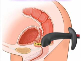 Speeltjes Electro Shock Anale Plug voor haar en hem.