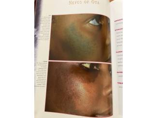 School- en Studieboeken Dermatological atlas of black skin - Connolly, Bikowski
