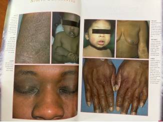 School- en Studieboeken Dermatological atlas of black skin - Connolly, Bikowski