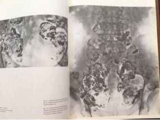 Medisch en Gezondheid Atlas of lymphography - Dr. T. de Roo