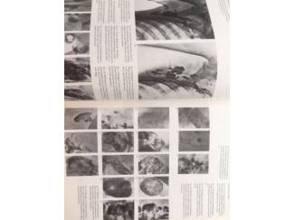 Medisch en Gezondheid Atlas of lymphography - Dr. T. de Roo