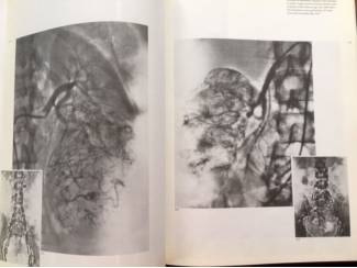 Medisch en Gezondheid Atlas of lymphography - Dr. T. de Roo